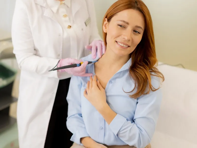 Dermal filler treatment